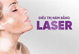 Bắn Laser Nám Chân Sâu Máy Lần